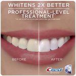 רצועות הלבנת שיניים קרסט 3D White Whitestrips בערכת מנורה ל10 טיפולים - Image 2