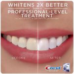 רצועות הלבנת שיניים קרסט 3D White Whitestrips בערכת מנורה ל10 טיפולים - Image 5